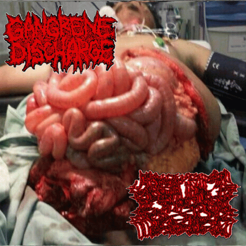 Gangrene Discharge : Gangrene Discharge - Blunted Torso